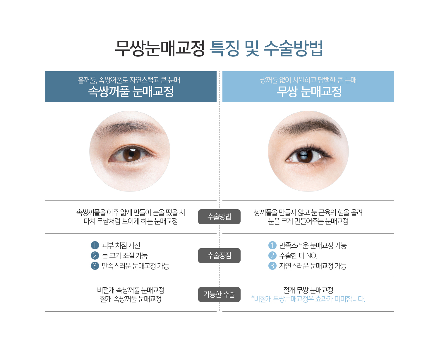 무쌍눈매교정 특징 및 수술방법